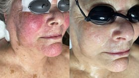 메이크오버 스킨케어 & 레이저